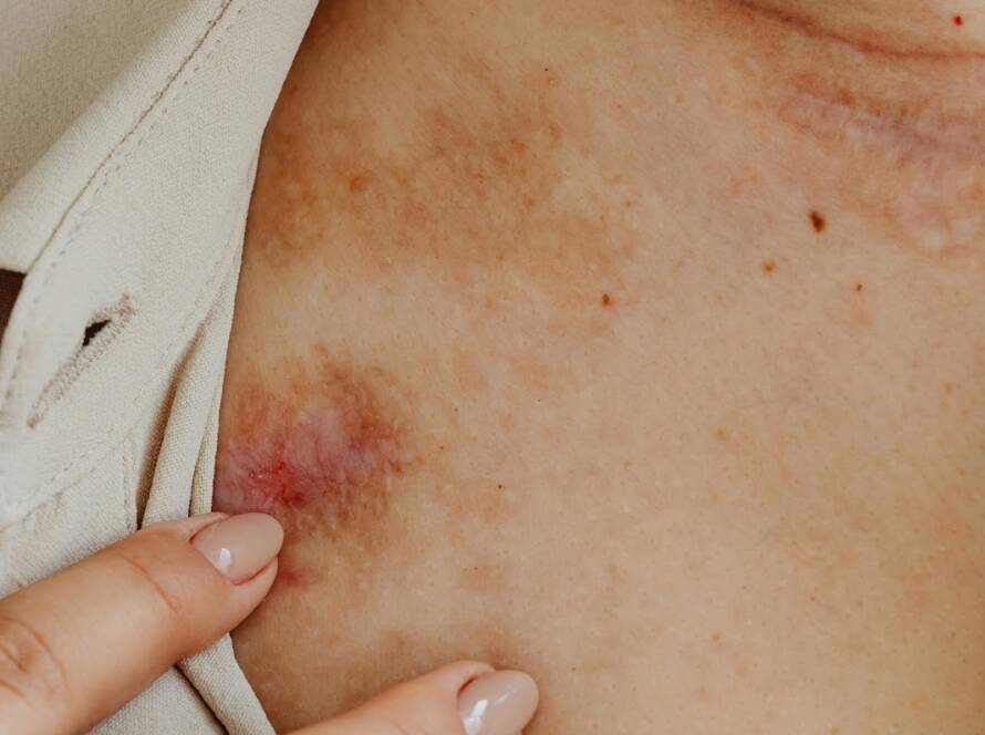 skin-infections-2