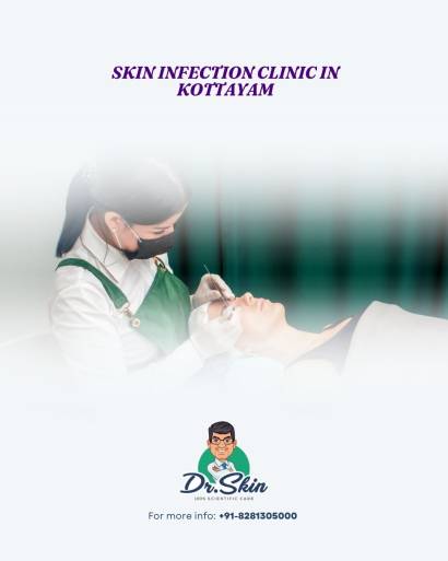 Skin infection clinic in Kottayam - Dr. Skin Clinic